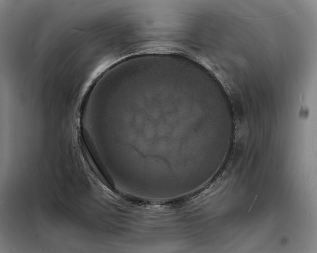X0000098181459200804241210