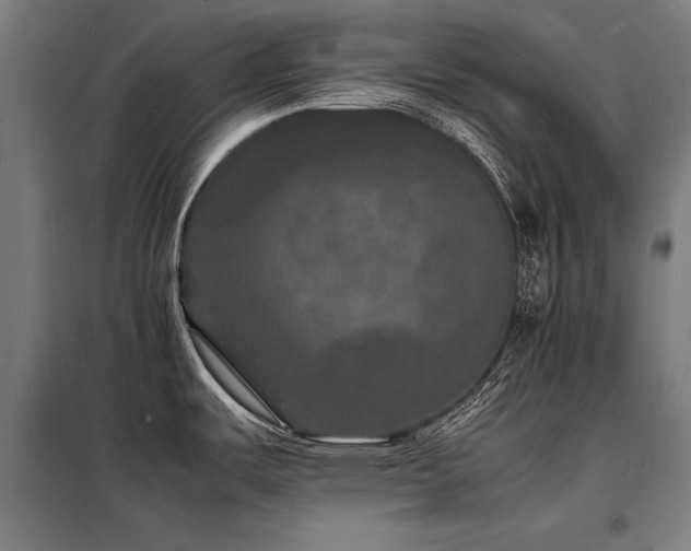 X0000098181487200804241210