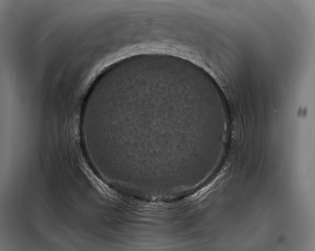 X0000098181499200804241209