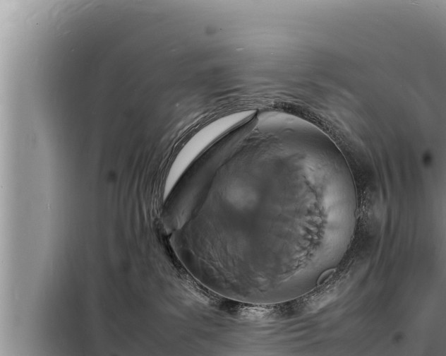 X0000098180139200805011045