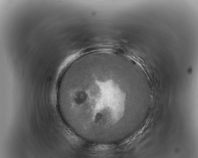 X0000098180149200805011044