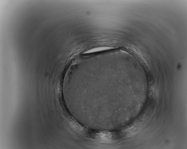 X0000098180317200805011042