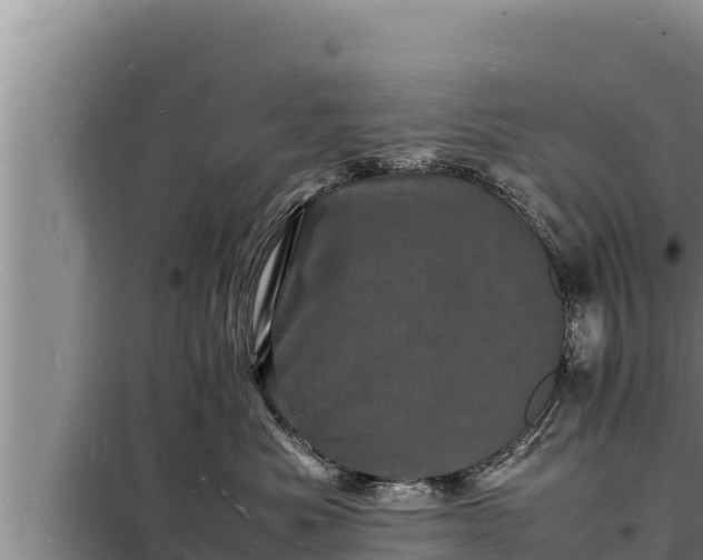 X0000098180525200805011039