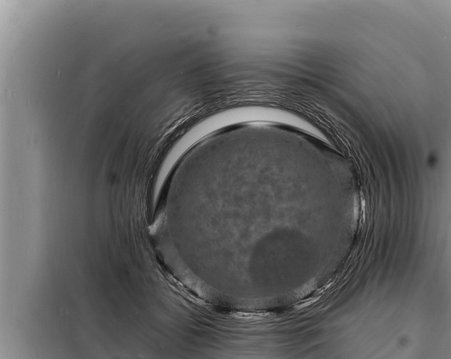 X0000098180556200805011038