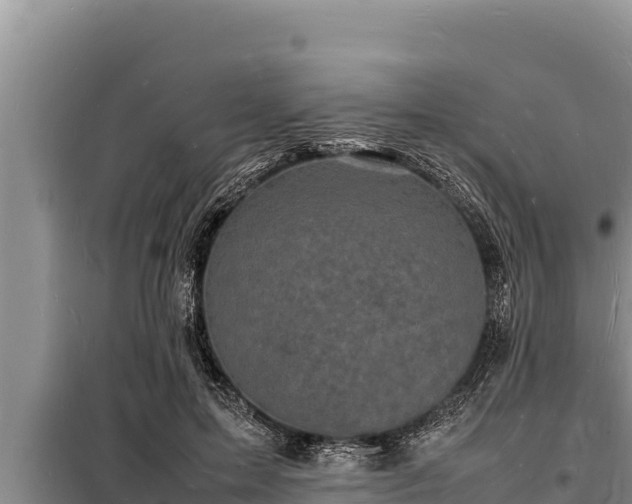 X0000098180599200805011038