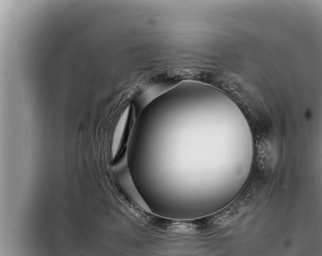 X0000098180617200805011037