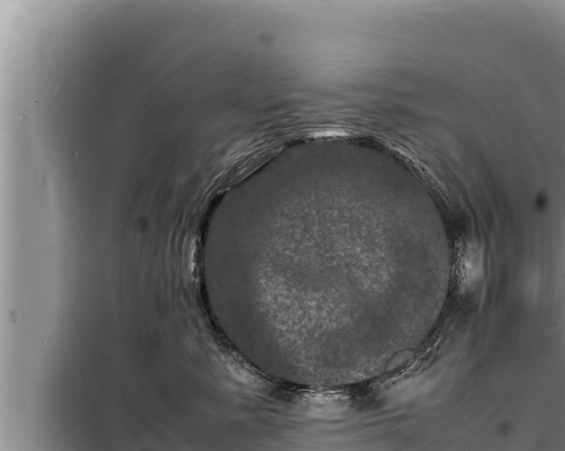 X0000098180619200805011037