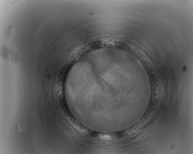 X0000098180706200805011036