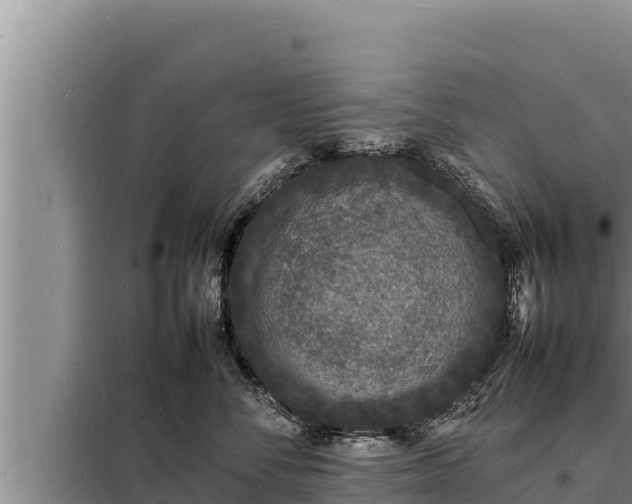 X0000098180716200805011036