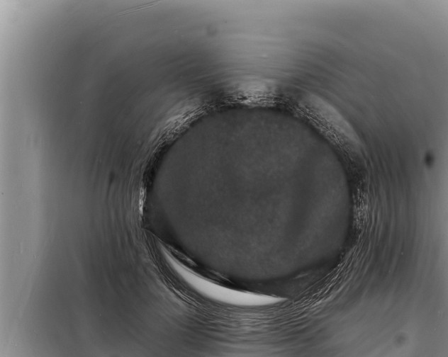 X0000098180748200805011035