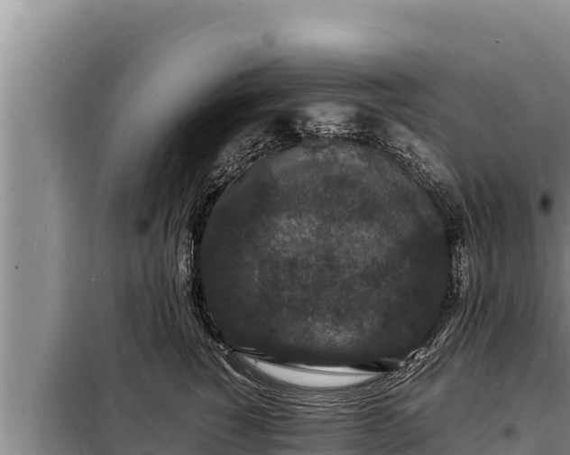 X0000098180760200805011036