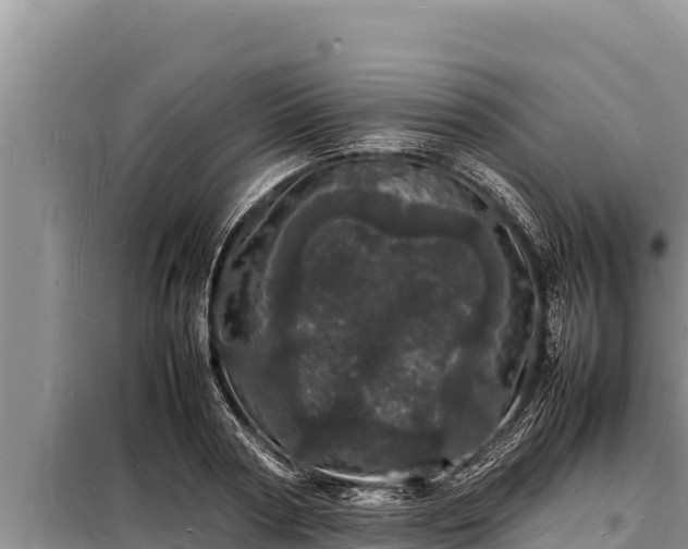 X0000098180794200805011035