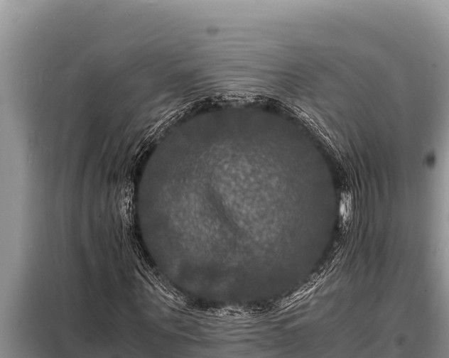 X0000098180867200805011034