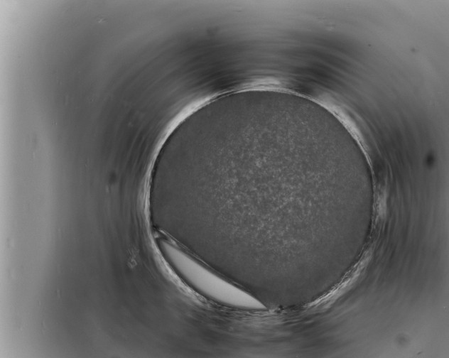 X0000098180957200805011033