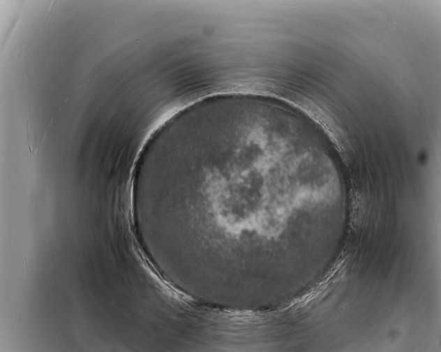 X0000098180982200805011032