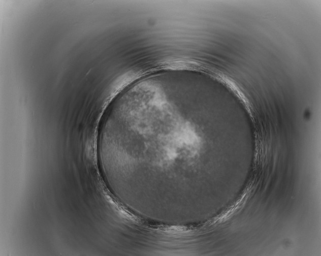 X0000098180986200805011032