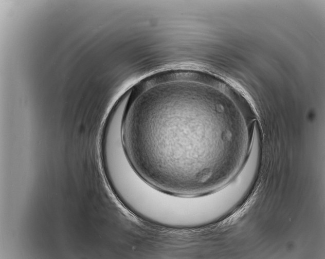 X0000098180989200805011032