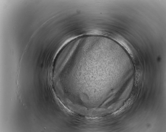 X0000098181000200805011032