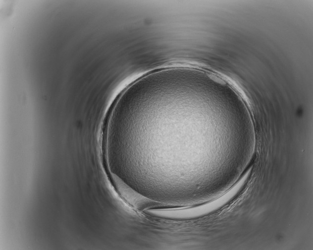 X0000098181003200805011032