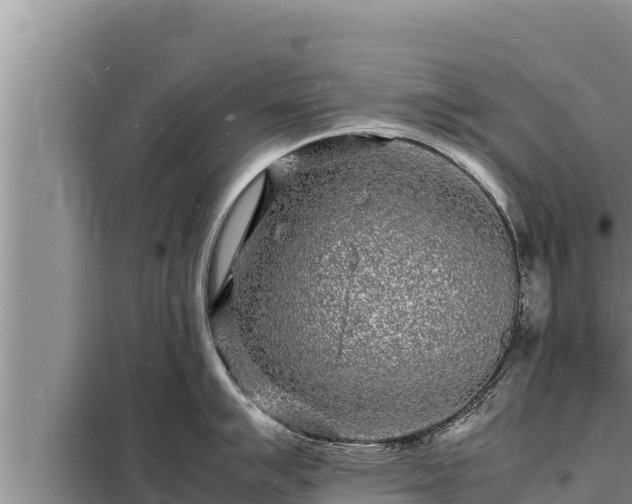 X0000098181007200805011031