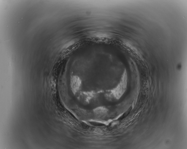 X0000098181013200805011031