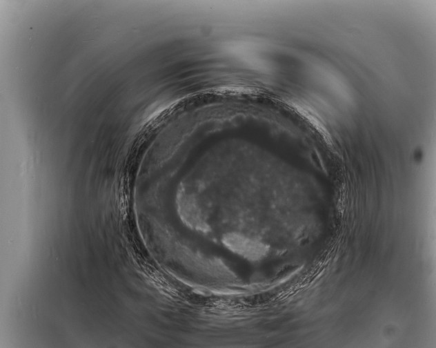 X0000098181015200805011031