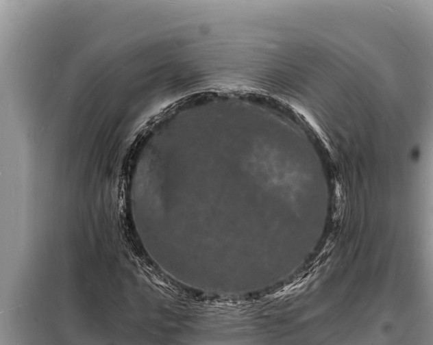 X0000098181016200805011031