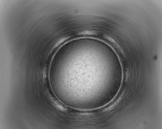 X0000098181017200805011031