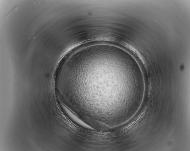 X0000098181019200805011031