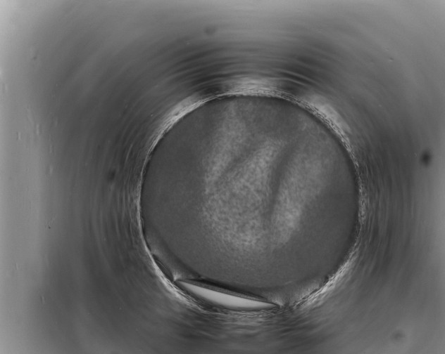 X0000098181041200805011031