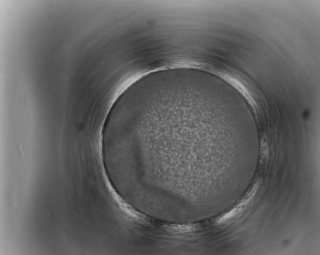 X0000098181047200805011031