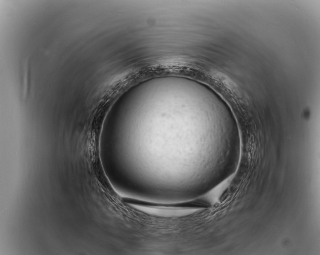 X0000098181062200805011031