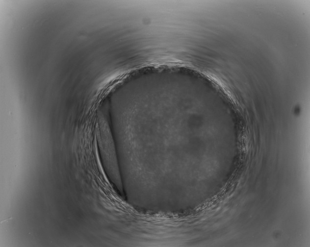 X0000098181063200805011031