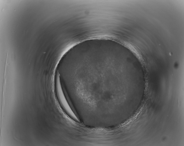 X0000098181079200805011030