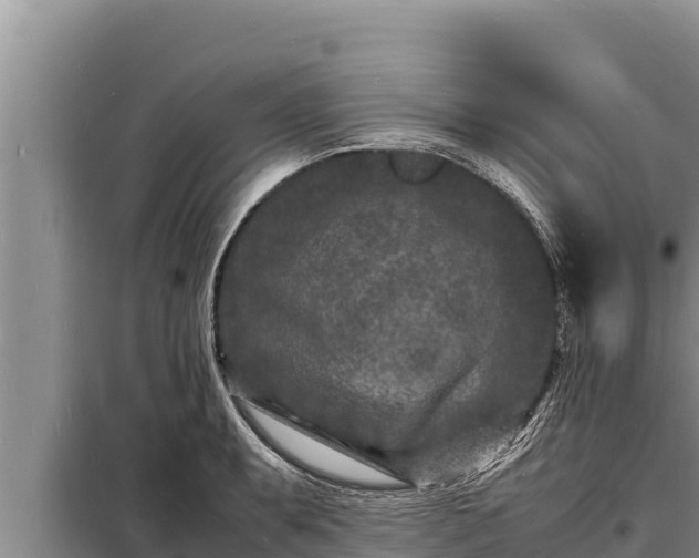 X0000098181087200805011030