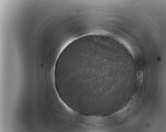 X0000098181103200805011030