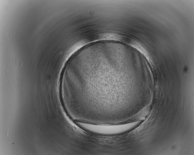 X0000098181135200805011030