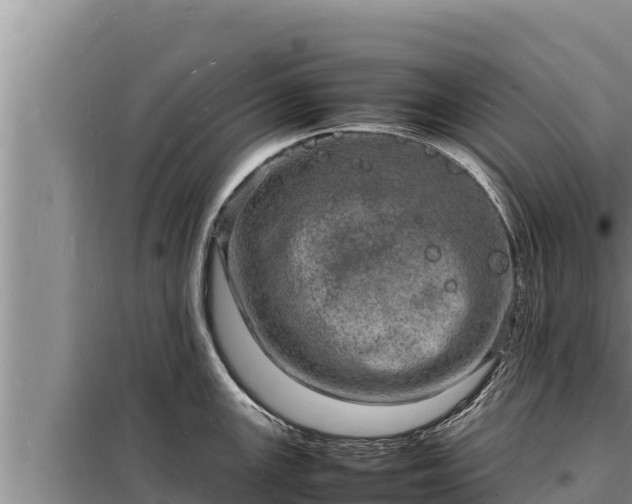 X0000098181147200805011030