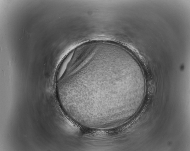 X0000098181167200805011029