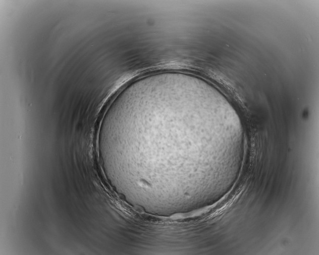 X0000098181170200805011029