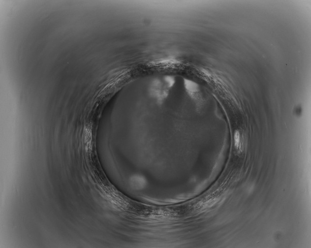 X0000098181203200805011028