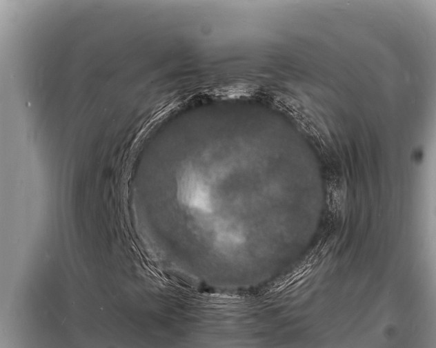 X0000098181393200805011025