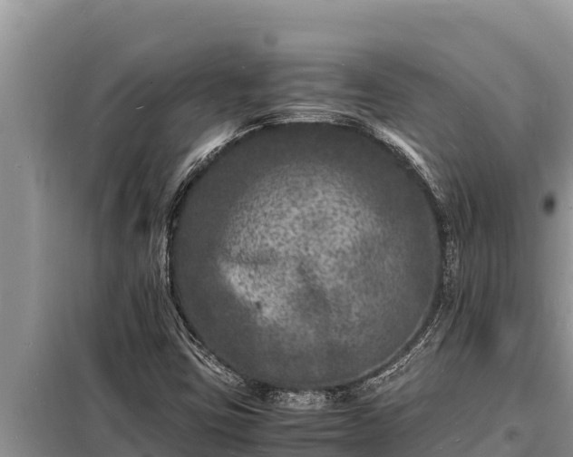 X0000098181403200805011025