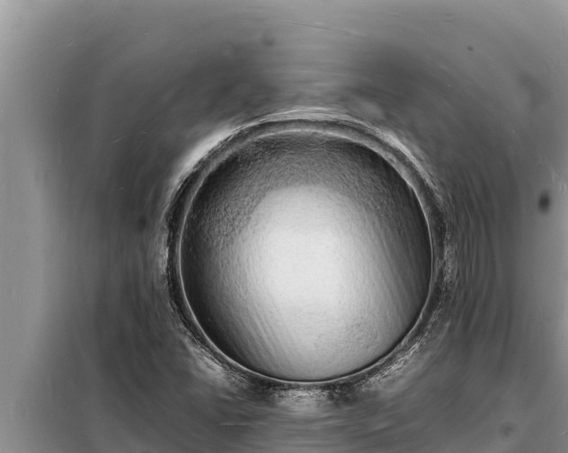 X0000098181406200805011025