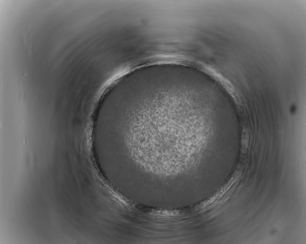 X0000098181411200805011025