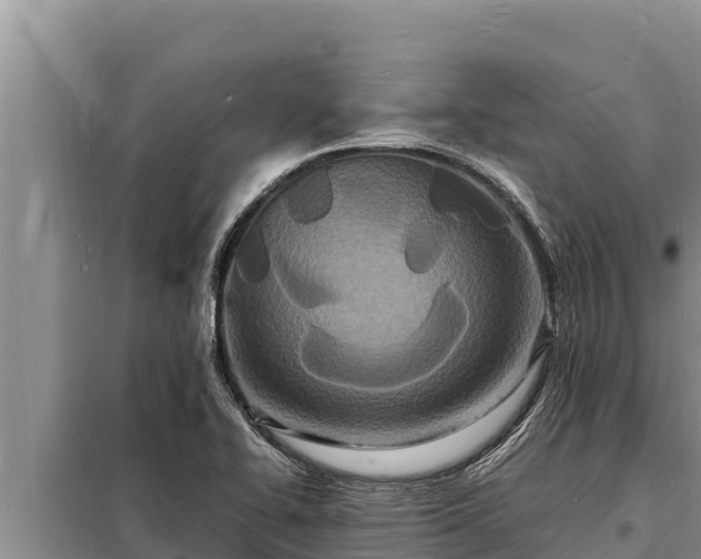 X0000098181414200805011025
