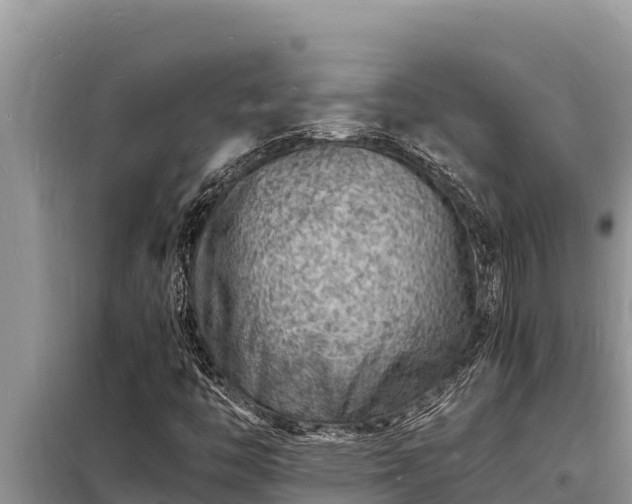 X0000098181446200805011025