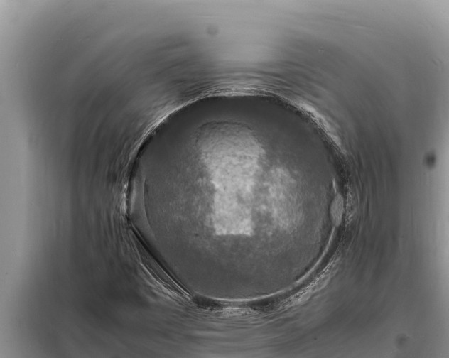 X0000098181449200805011025