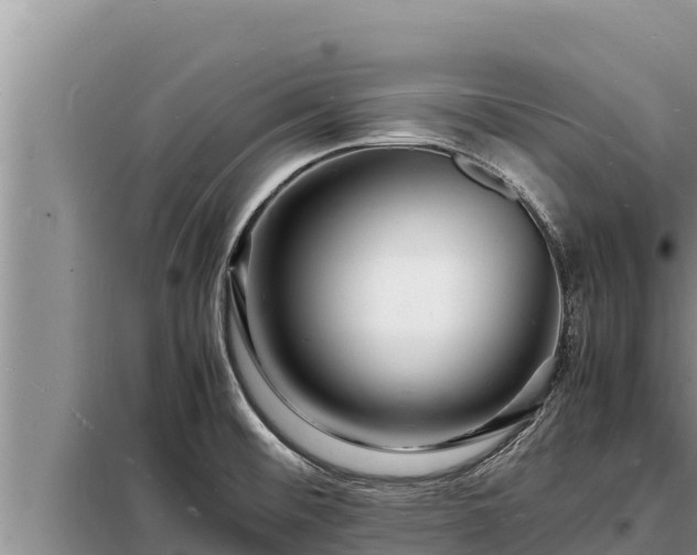 X0000098181476200805011025