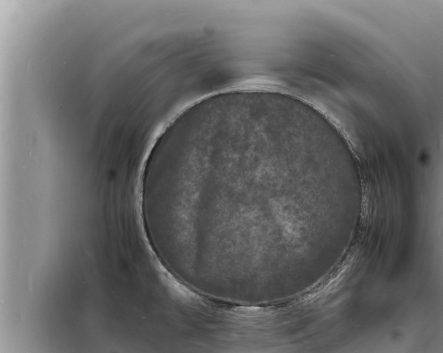X0000098181478200805011025